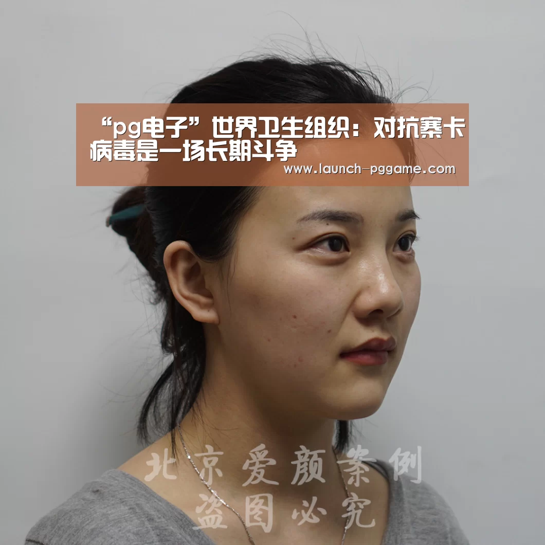 “pg电子”世界卫生组织:对抗寨卡病毒是一场长期斗争(图1) pg电子